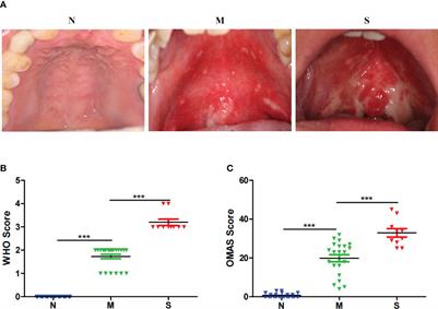 Distinctive microbiota of delayed healing of oral mucositis after radiotherapy of nasopharyngeal carcinoma